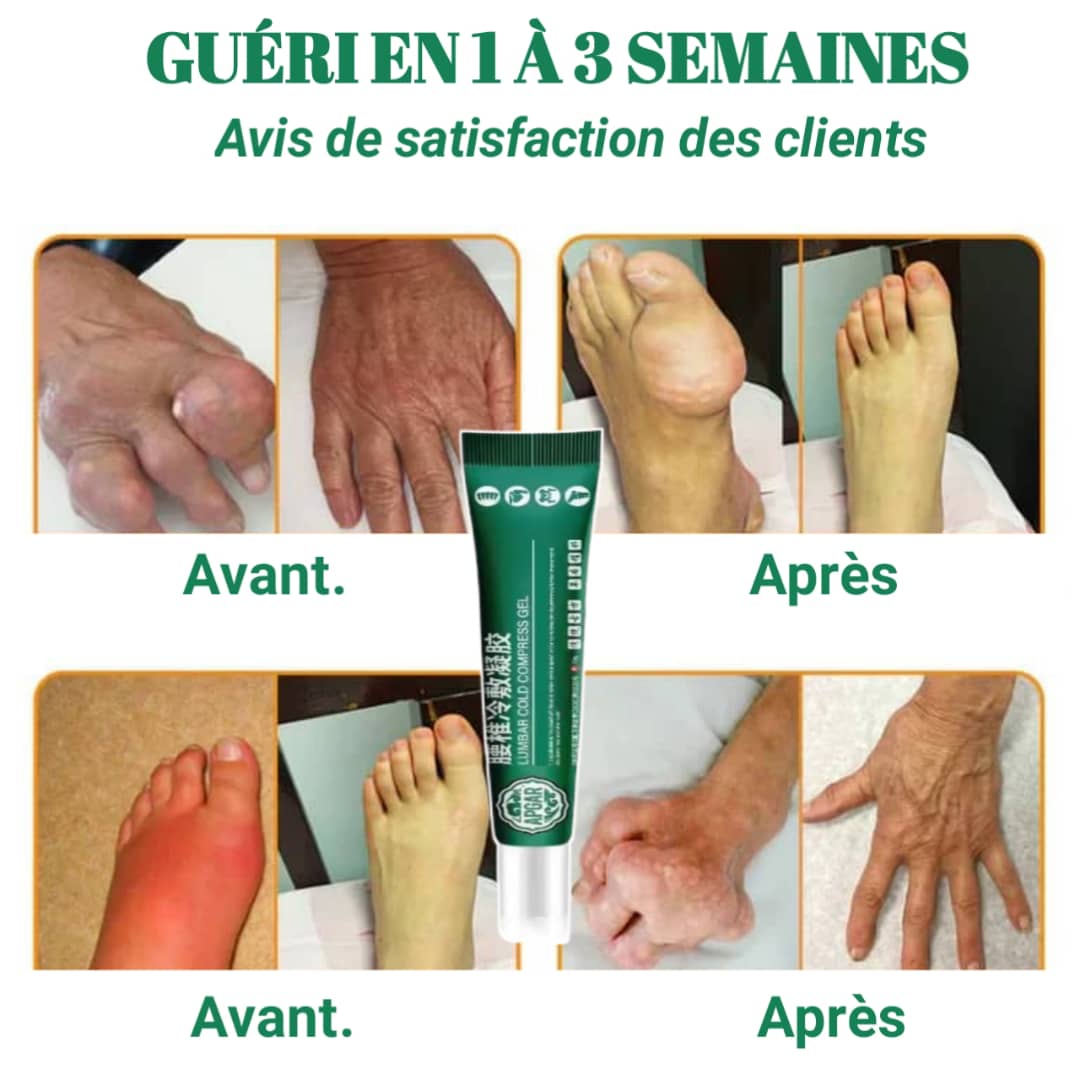 Gel Réparateur Articulaire – Soulagement Rapide et Profond des Douleurs